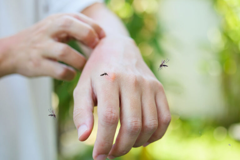 chto-delaet-s-ljudmi-lihoradka-chikungunja-est-li-ugroza-dlja-rossii-cfebf0b